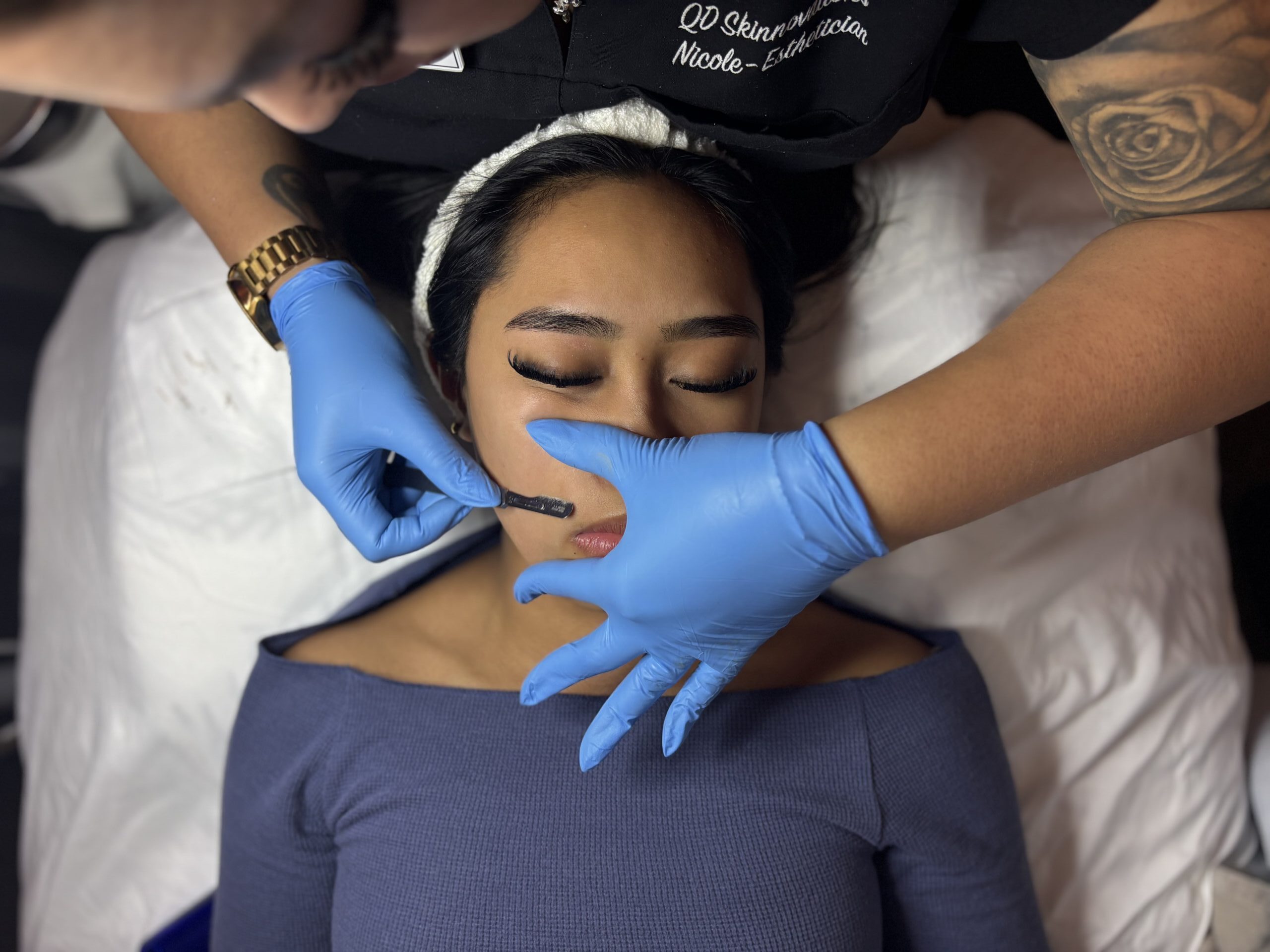 qd-skinnovations-dermaplaning