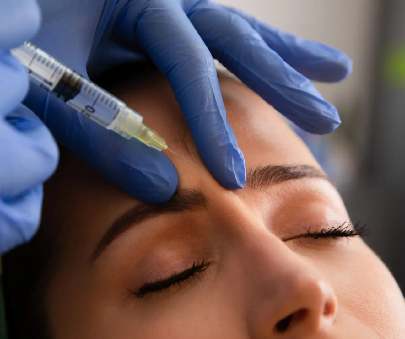 Botox in Carson at QD Skinnovations