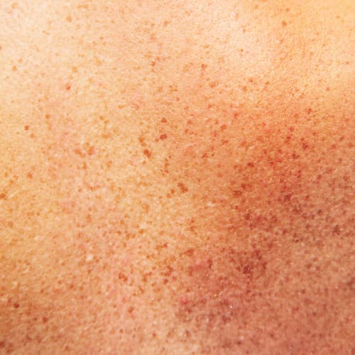 egd58 Melanin