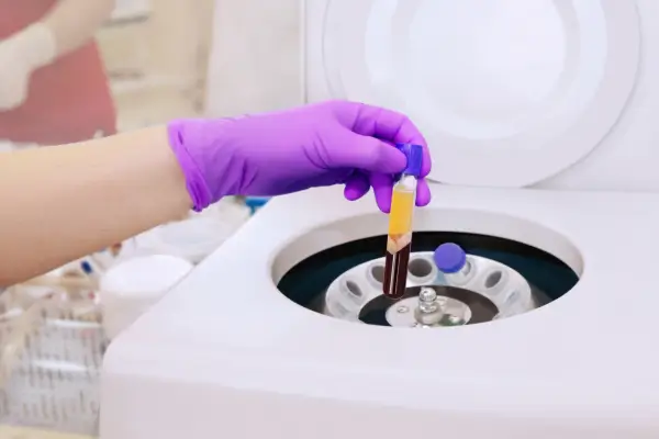 prp therapy process