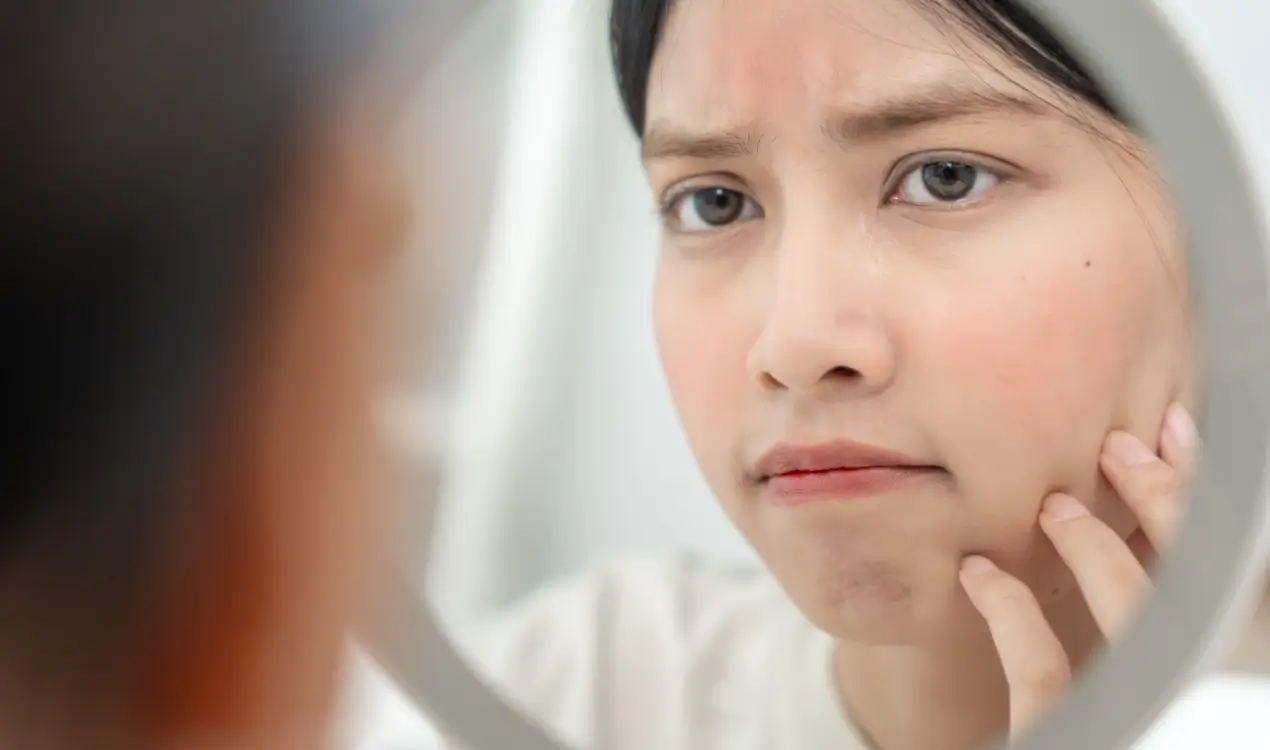 girl confused about facials vs lasers vs injectables
