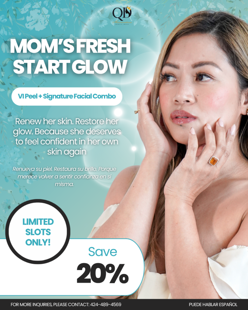 VI Peel + Facial Mother's Day Combo (20% Off) South Bay
